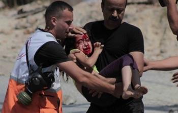 اصابة طفلة برصاص الاحتلال