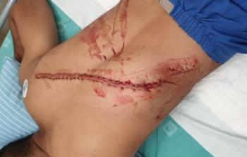 علامات الاعتداء الخطير على النصاصرة