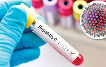 احصائية منظمة الصحة العالمية عن المصابين بمرض التهاب الكبد الفيروسي