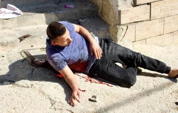 استشهاد الشاب عمر البدوي برصاص الاحتلال بالخليل