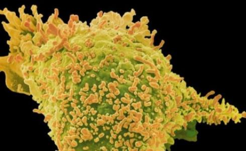 هناك عوامل وراثية تتدخل في الإصابة بالسرطان