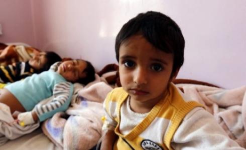 تعرض أطفال يمنيون إلى الإصابة بوباء الكوليرا