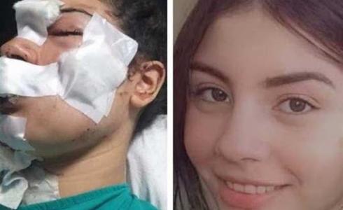 قصة إسراء عماد ضحية التعذيب على يد زوجها