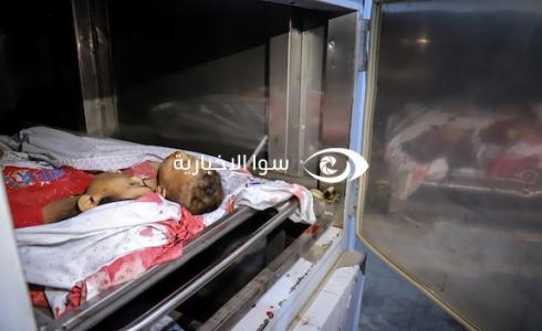 أحد الشهداء الأطفال في غزة بعد وصوله إلى المستشفى