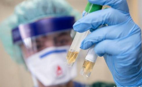 كورونا - تعبيرية