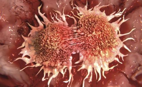 خلايا سرطانية - صورة تعبيرية