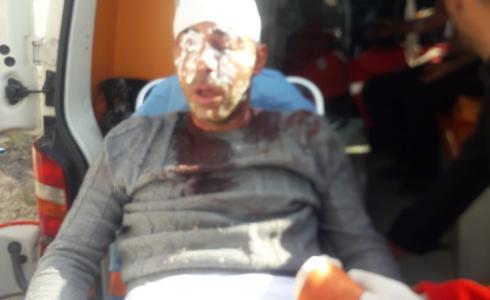 جانب من الاعتداء على المزارعين في نابلس