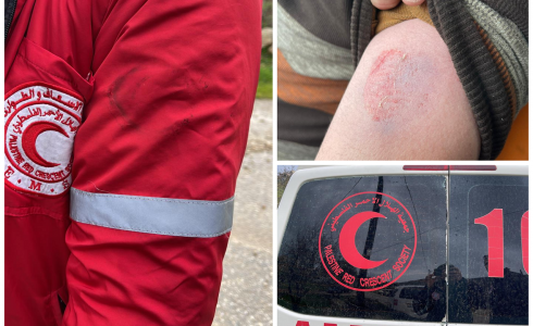 إصابات خلال مواجهات مع الاحتلال في الضفة