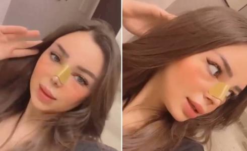 خشم رهف القحطاني بعد جراحة تجميلية