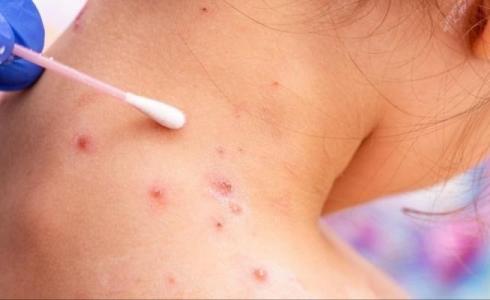 صورة تعبيرية