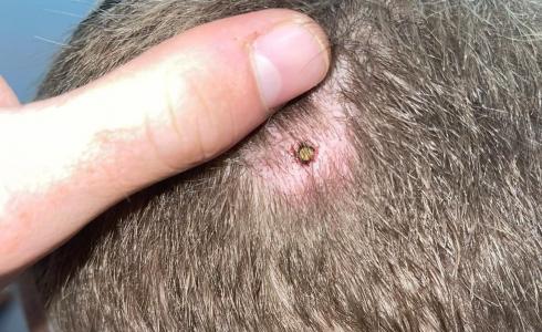 صورة للضابط المصاب