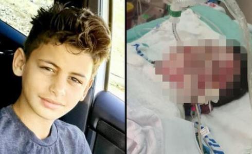 الطفل عيسى أبو القيعان