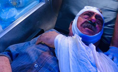 إصابات في اعتداء للمستوطنين شمال رام الله