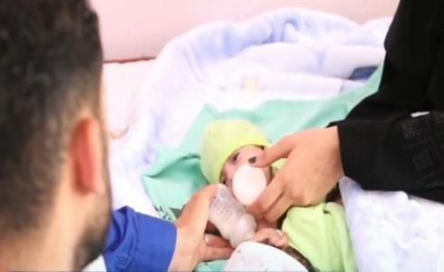 بتوجيهات من خادم الحرمين ..وصول التوأم السيامي العراقي إلى السعودية
