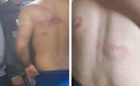 اختطاف عمال فلسطينيين في الجليل