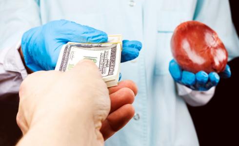 بيع الكلي مقابل المال