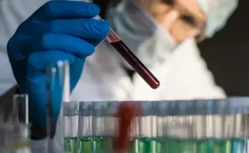 الصحة المصرية تكشف تفاصيل "المرض الغامض" الذي ظهر في قرية الصعيد