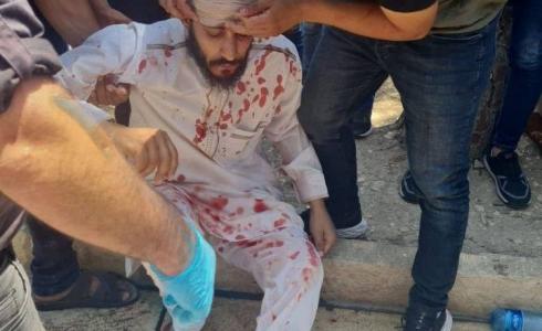 مواطن مصاب جرّاء اعتداءات الاحتلال عند باب الأسباط