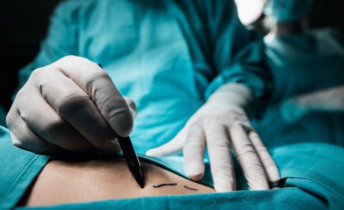 الضفة - إجراء أكثر من 40 ألف عملية جراحية خلال الـ8 أشهر الماضية