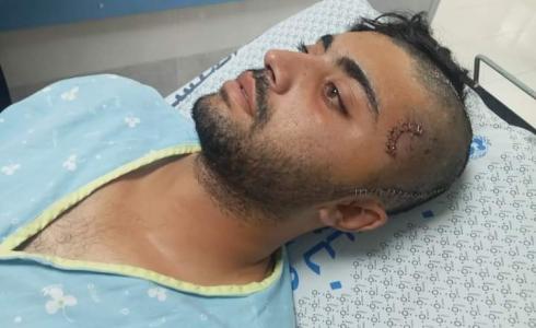 الاحتلال يفرج عن صياد مصاب من قطاع غزة