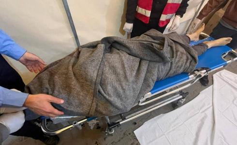غزة - 73 شهيدا وصولوا مستشفى شهداء الأقصى في 24 ساعة