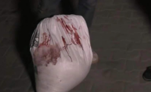 طحين مغمس بالدماء جرّاء مجزرة الكويت في غزة