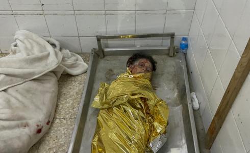 غزة – 26 شهيدا وعشرات الجرحى في غارات إسرائيلية منذ الصباح
