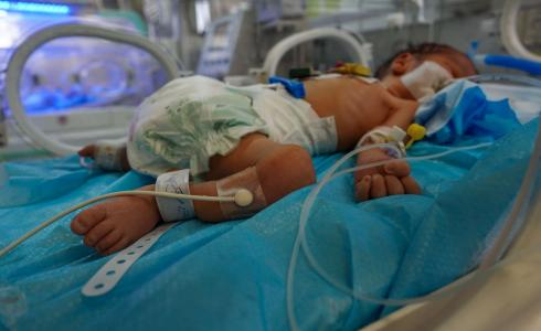 سوء التغذية في غزة خطر على حديثي الولادة