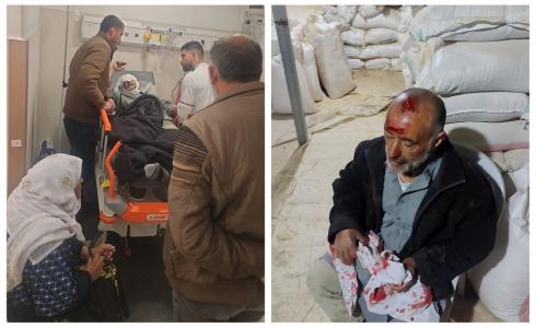 إصابة مواطن في هجوم للمستوطنين جنوب الخليل