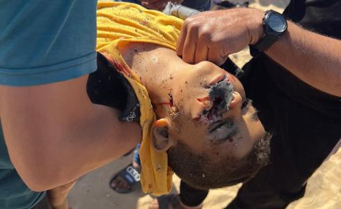19 شهيدا في مجزرة عيادة الأونروا بجباليا
