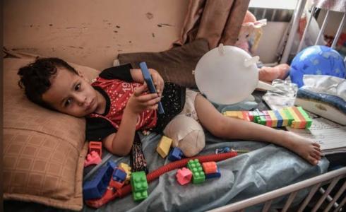 طفولة مبتورة وأحلام باقية: أحمد شاهد على جراح أطفال غزة