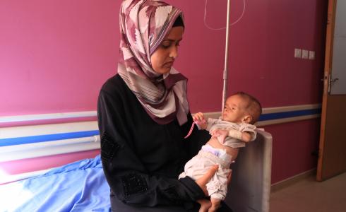 أطفال يعانون من سوء التغذية في غزة