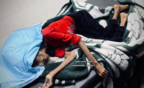 ارتفاع عدد المتوفين نتيجة التجويع في غزة إلى 20 خلال يومين