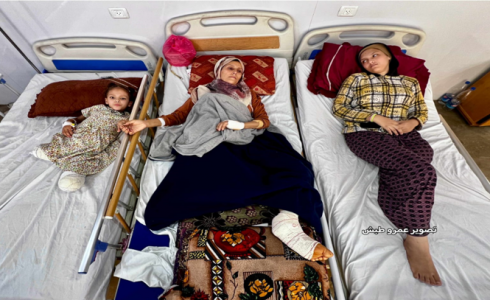 الحرب على غزة... بتر وإعاقات وجحيم لا يُطاق