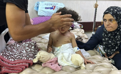 بتر الأطراف في غزة: مأساة إنسانية تتفاقم جرّاء الحرب