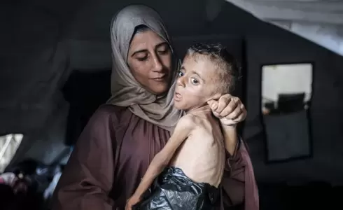 الأونروا- سكان غزة يعيشون الجوع والصدمة رغم وقف إطلاق النار