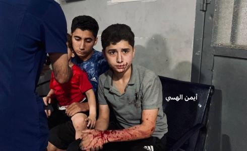 أطفال مصابون جراء القصف الإسرائيلي الليلة على غزة
