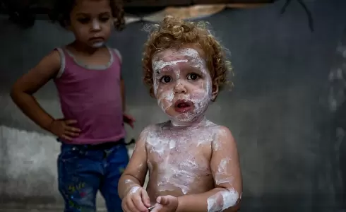 أمراض جلدية في غزة