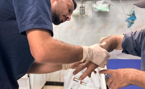 غزة : شهيدان و13 جريحاً بغارة إسرائيلية استهدفت مركبة مدنية