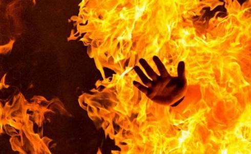 شخص يحترق -توضيحية-