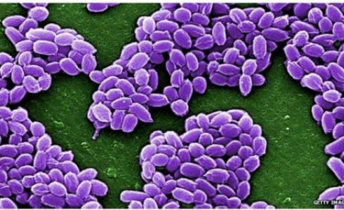 يمكن معالجة الجمرة الخبيثة بالمضادات الحيوية