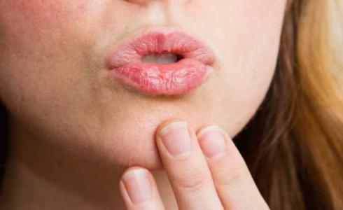 طرق الوقاية من تشقق الشفاه في الشتاء