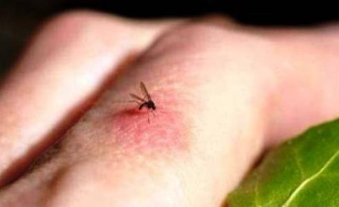 طرق الوقاية من لدغات البعوض