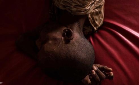 وفاة 20 شخصا 