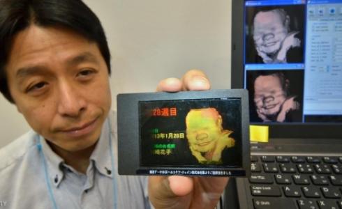 يتم تحويل بيانات الفحص بالموجات فوق الصوتية قبل تحويلها إلى صيغة مجسمة (الصورة أرشيفية)