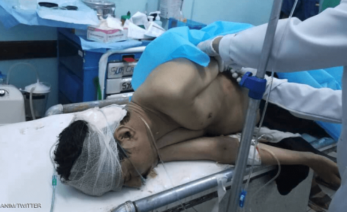 اصابة نتيجة القصف