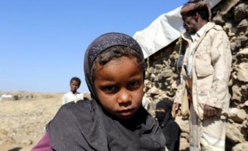 ملايين اليمنيين بحاجة إلى مساعدات غذائية