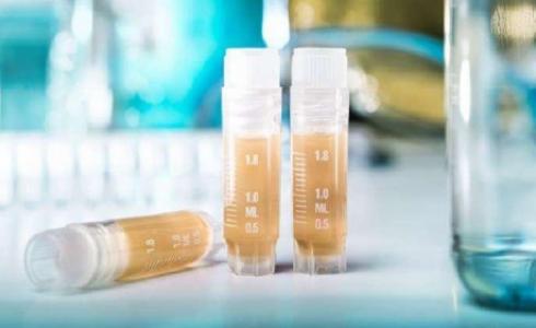 التهاب الكبد