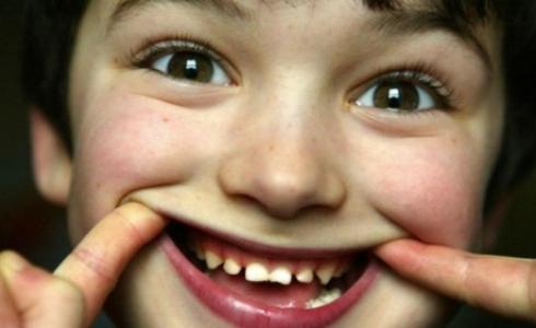 يحرص أطباء الأسنان في بريطانيا عند فحص أسنانهم على وضع مادة الفلوريد لحمايتها من التسوس