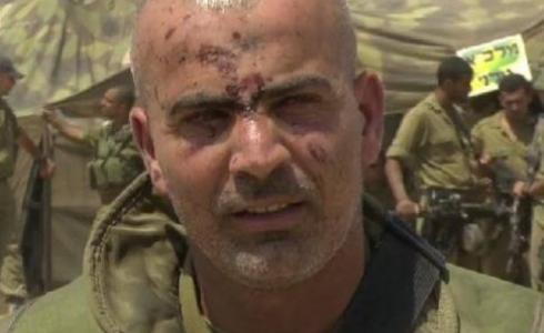  غسان عليان أصيب في حرب 2014 على غزة